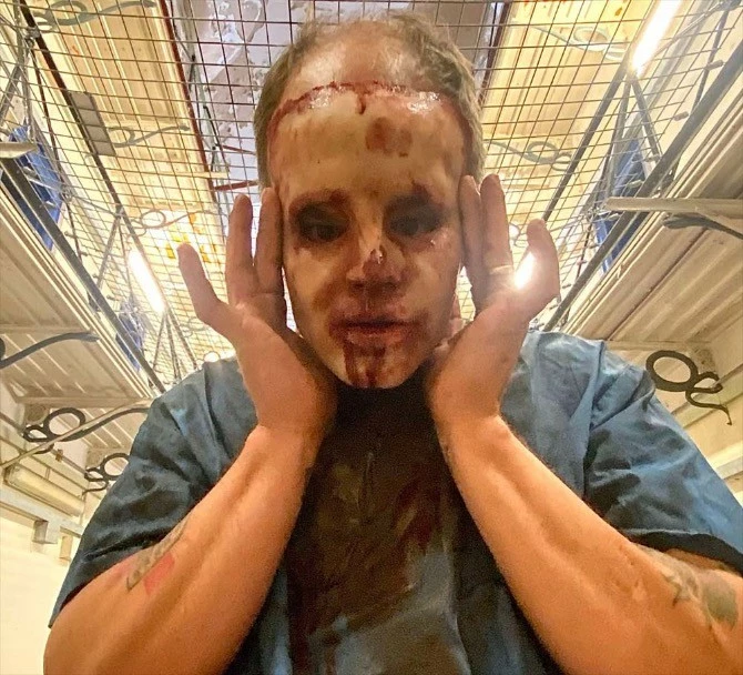 Other Bloody Medical Scrubs - Image 4