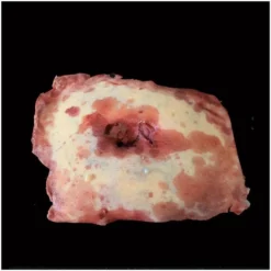 Other Silicone Severed Belly Button