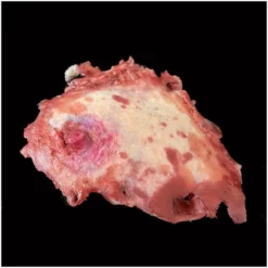 Other Silicone Severed Nipple